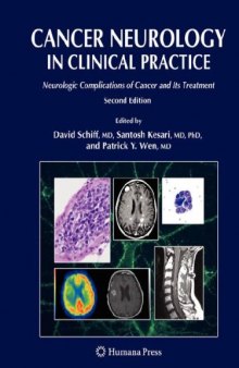 Cancer Neurology in Clinical Practice; Neurologic Complications of Cancer and Its Treatment