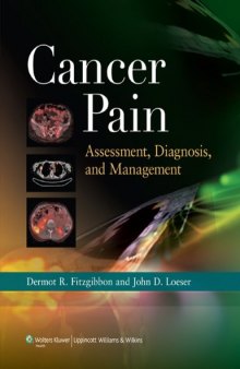 Cancer Pain: Assessment, Diagnosis, and Management