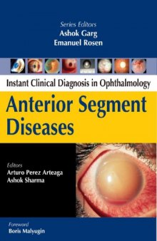 Anterior Segment Diseases (Instant Clinical Diagnosis in Ophthalmology)
