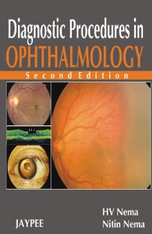 Diagnostic Procedures in Ophthalmology 2nd Edition  