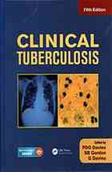 Clinical Tuberculosis 4th Edition