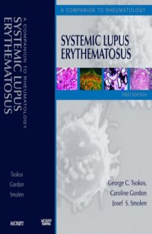 Systemic Lupus Erythematosus: A Companion to Rheumatology