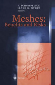 Meshes: Benefits and Risks