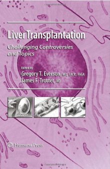 Liver Transplantation: Challenging Controversies and Topics (Clinical Gastroenterology)
