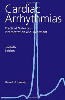 Cardiac Arrhythmias: Practical Notes on Interpretation and Treatment  