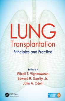 Lung transplantation : principles and practice