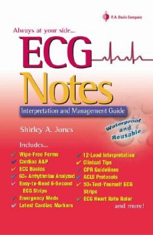 ECG Notes. Interpretation and Management Guide