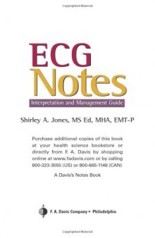 ECG Notes: Interpretation And Management Guide