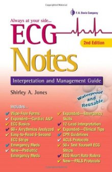 ECG Notes: Interpretation and Management Guide, 2nd Edition (Davis's Notes)  
