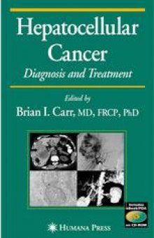 Hepatocellular Cancer: Diagnosis and Treatment