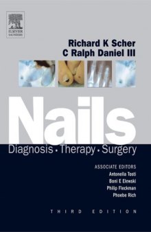 Nails: Diagnosis, Therapy, Surgery, Third Edition