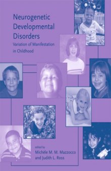 Neurogenetic developmental disorders: variation of manifestation in childhood