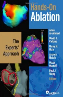 Hands-on Ablation: The Experts' Approach