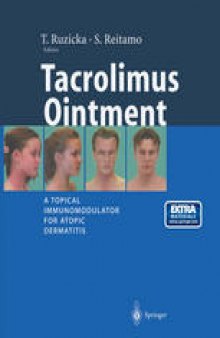 Tacrolimus Ointment: A Topical Immunomodulator for Atopic Dermatitis