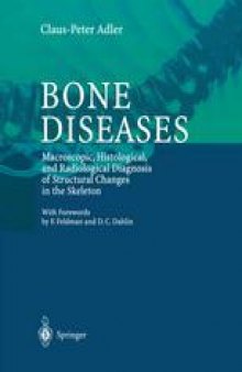 Bone Diseases: Macroscopic, Histological, and Radiological Diagnosis of Structural Changes in the Skeleton