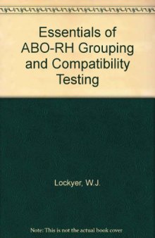 Essentials of ABO–Rh Grouping and Compatibility Testing. Theoretical Aspects and Practical Application