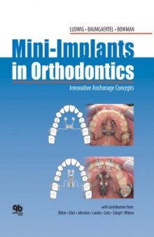 Mini-implants in Orthodontics: Innovative Anchorage Concepts