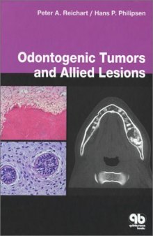 Odontogenic tumors and allied lesions  