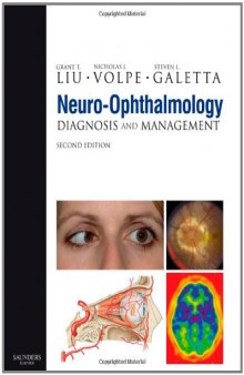 Neuro-Ophthalmology: Diagnosis and Management, Second Edition  