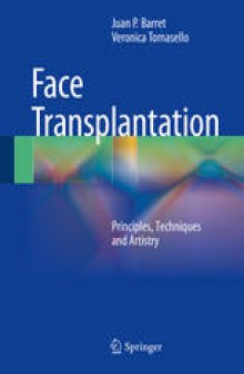 Face Transplantation: Principles, Techniques and Artistry