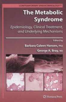 The Metabolic Syndrome: Epidemiology Clinical Treatment and Underlying Mechanisms
