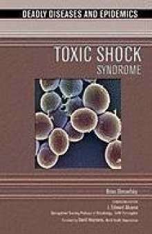 Toxic Shock Syndrome 