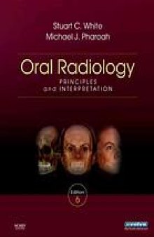 Oral radiology : principles and interpretation