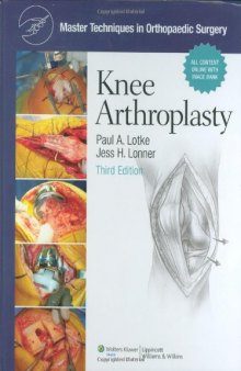 Master Techniques in Orthopaedic Surgery: Knee Arthroplasty