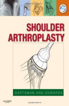 Shoulder Arthroplasty