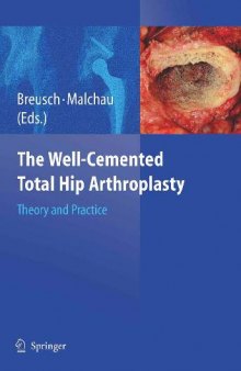The Well-cemented Total Hip Arthroplasty