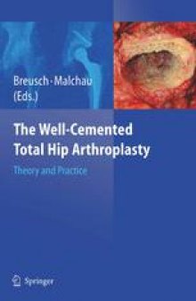The Well-Cemented Total Hip Arthroplasty: Theory and Practice