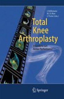 Total Knee Arthroplasty: A Guide to Get Better Performance