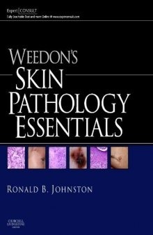Weedon's Skin Pathology Essentials: Expert Consult: Online and Print