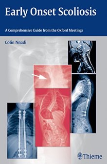 Early Onset Scoliosis: A Comprehensive Guide from the Oxford Meetings