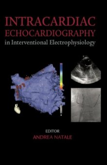 Intracardiac Echocardiography in Interventional Electrophysiology: Advanced Management of Atrial Fibrillation and Ventricular Tachycardia