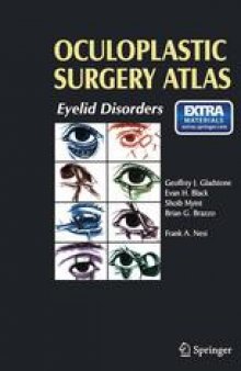 Oculoplastic Surgery Atlas: Eyelid Disorders