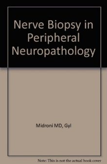 Biopsy Diagnosis of Peripheral Neuropathy