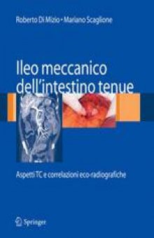 Ileo meccanico dell’intestino tenue: Aspetti TC e correlazioni eco-radiografiche