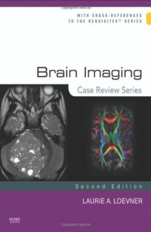 Brain Imaging: Case Review Series, Second Edition  