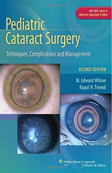 Pediatric cataract surgery : techniques, complications, and management