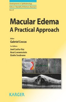 Macular Edema: A Practical Approach (Developments in Ophthalmology)