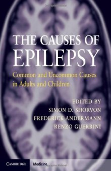 The Causes of Epilepsy: Common and Uncommon Causes in Adults and Children  