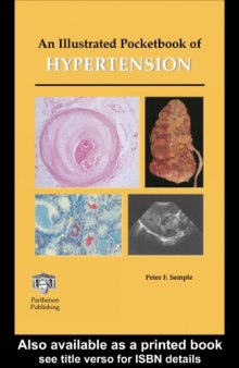 An Illustrated Pocketbook of Hypertension