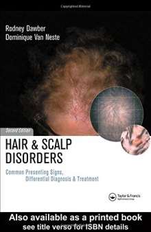 Hair and scalp disorders : common presenting signs, differential diagnosis and treatment