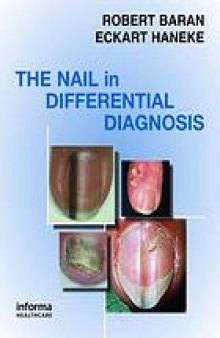 The nail in differential diagnosis