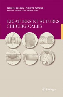 Ligatures et sutures chirurgicales