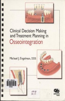 Clinical Decision Making and Treathment Planning in Osseointigration