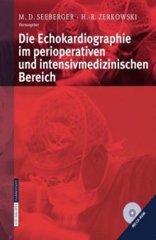 Die Echokardiographie im perioperativen und intensivmedizinischen Bereich 