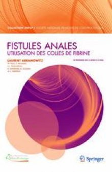 Fistules anales: Utilisation des colles de fibrine