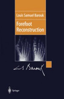 Forefoot Reconstruction